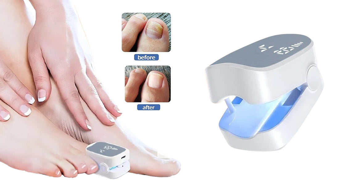 Laserterapienhed til Neglesvamp