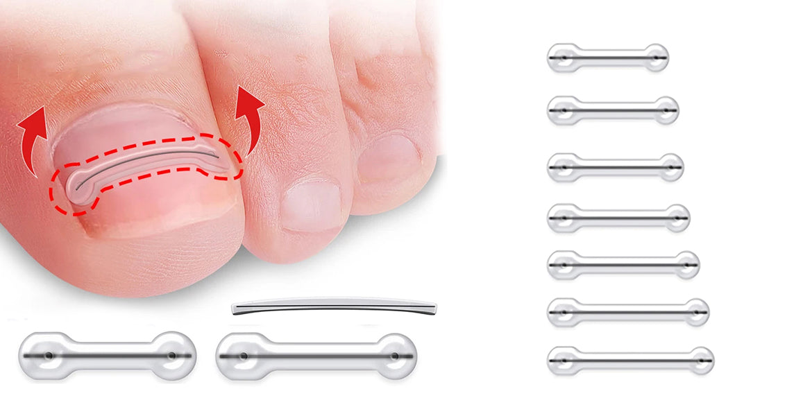 2 Stk. Nedgroet Tånegl Behandlingsplastre