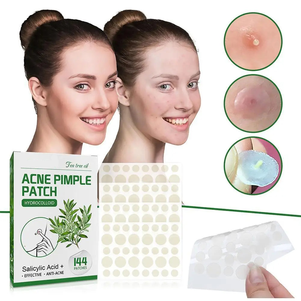 144 stk. Akne Pimple Patches med Salicylsyre