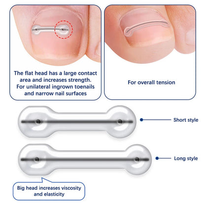 2 Stk. Nedgroet Tånegl Behandlingsplastre