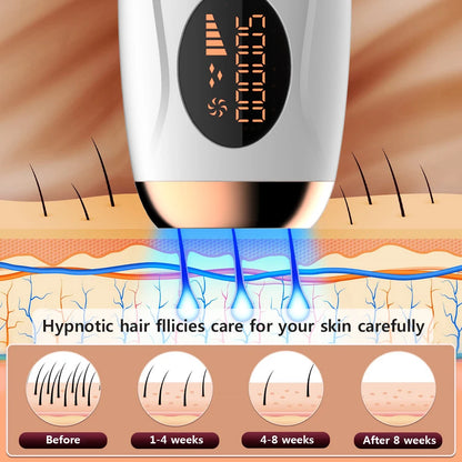 Avanceret Laser Epilator til Langvarig Glathed