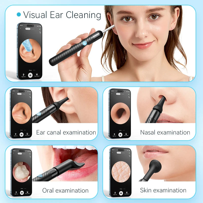 Trådløst Genopladeligt Ørerensesæt med Kamera