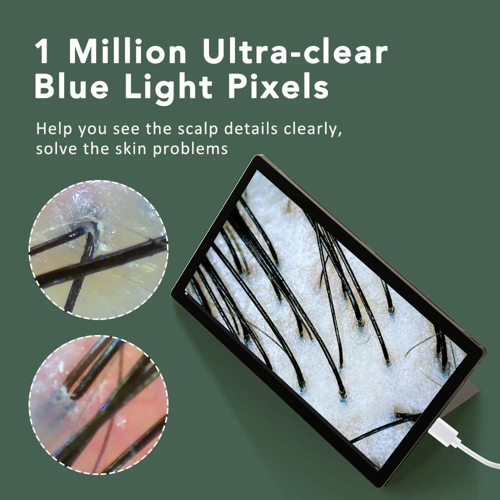 1000X Wifi Hud & Hovedbund Analyse