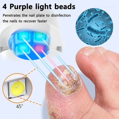 Lysterapi til Behandling af Neglesvamp