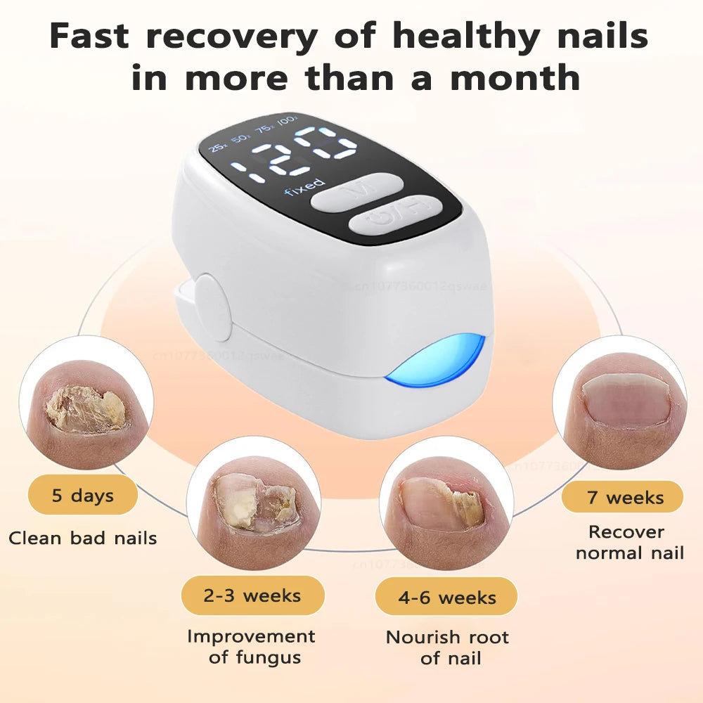 Lysterapi til Behandling af Neglesvamp