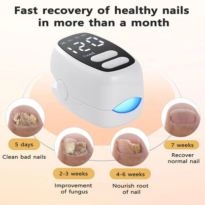 Lysterapi til Behandling af Neglesvamp