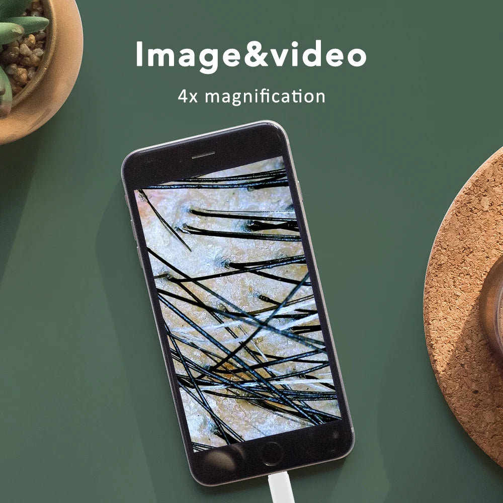 1000X Wifi Hud & Hovedbund Analyse