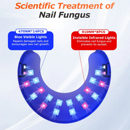 Trådløs Laserbehandling mod Neglesvamp