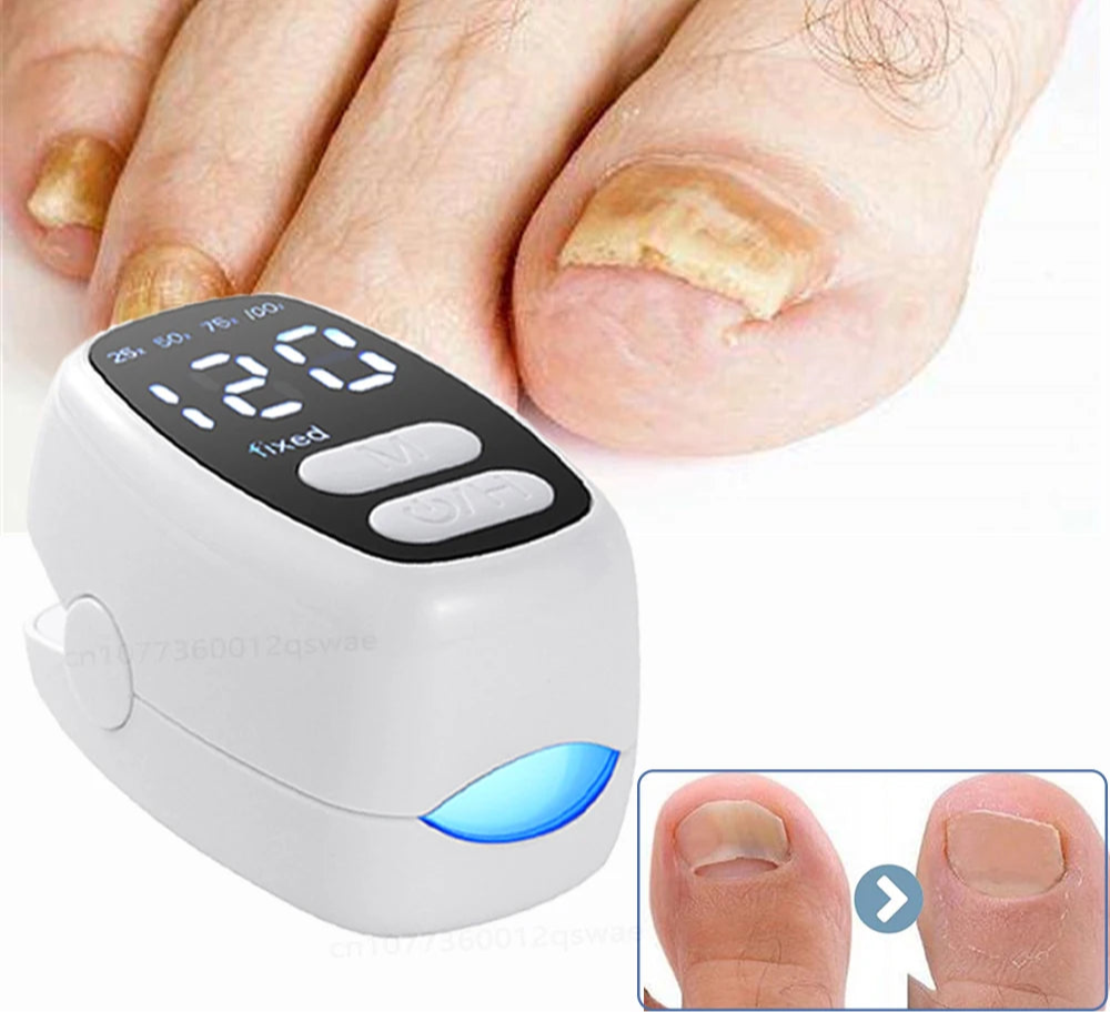 Lysterapi til Behandling af Neglesvamp