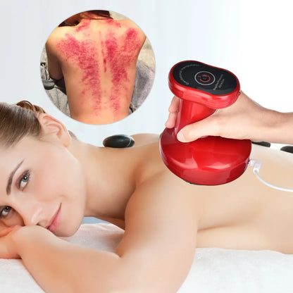 Elektrisk Cupping Massageapparat