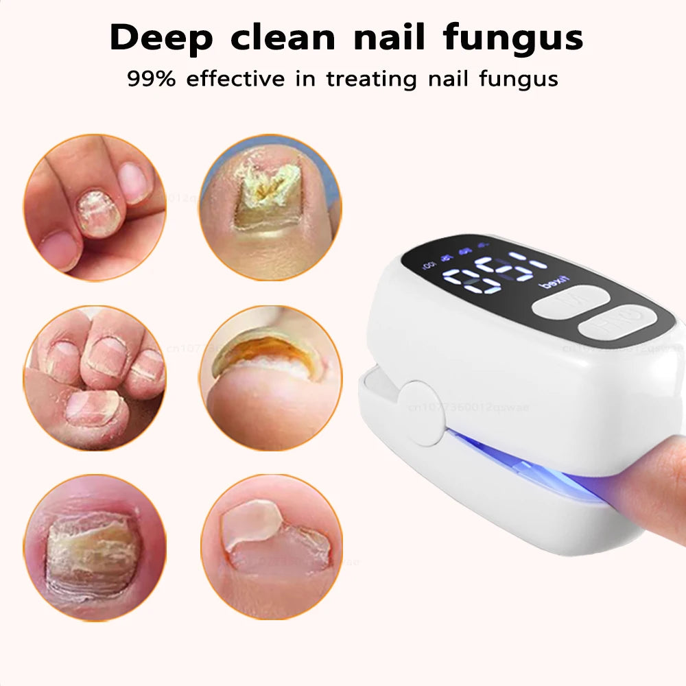 Lysterapi til Behandling af Neglesvamp