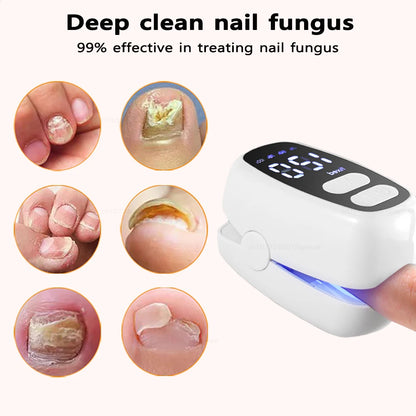 Lysterapi til Behandling af Neglesvamp