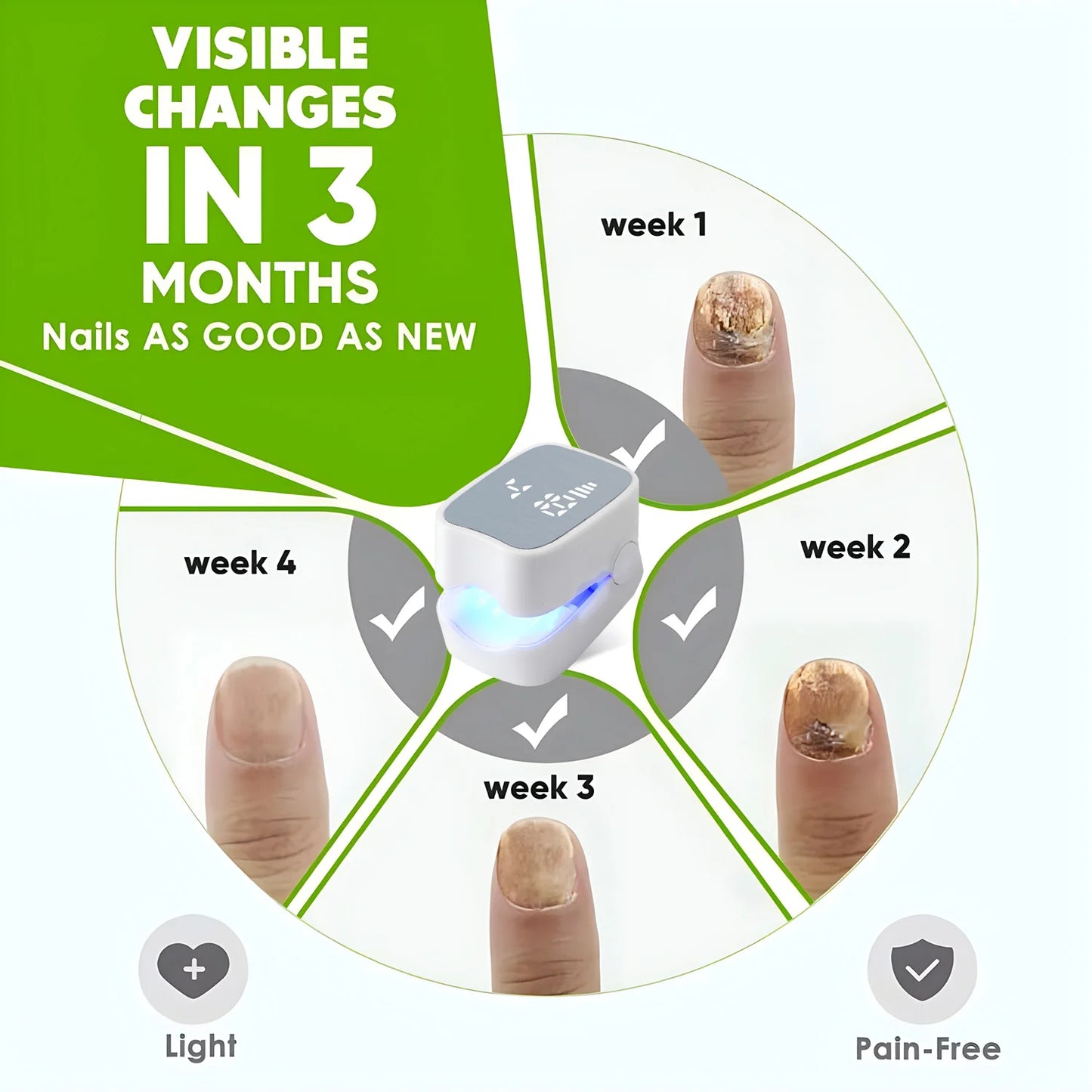 Laserterapienhed til Neglesvamp