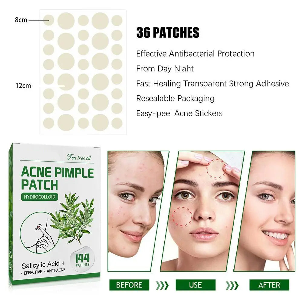 144 stk. Akne Pimple Patches med Salicylsyre