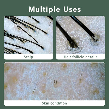 1000X Wifi Hud & Hovedbund Analyse